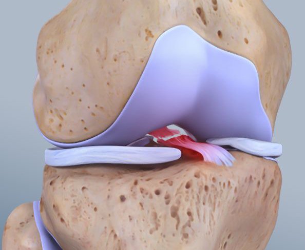knee